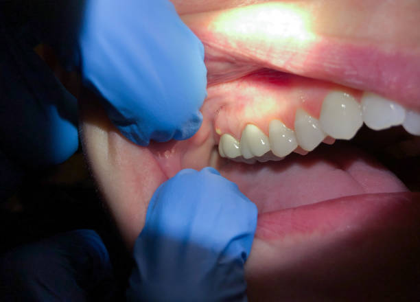 Best Pediatric Emergency Dentist in Galena, OH