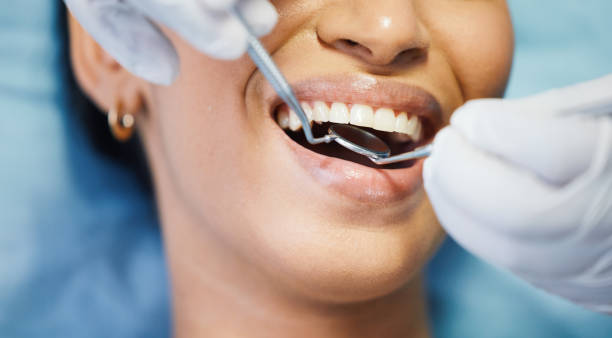 Best Emergency Treatment for Dental Infections or Abscesses in Galena, OH