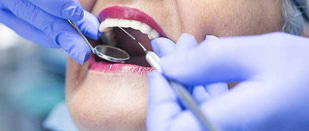 Best Emergency Tooth Extraction in Galena, OH
